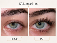 Serum do Rzęs LashBloom — Dłuższe, Gęstsze Rzęsy w 30 Dni — zdjęcie 3